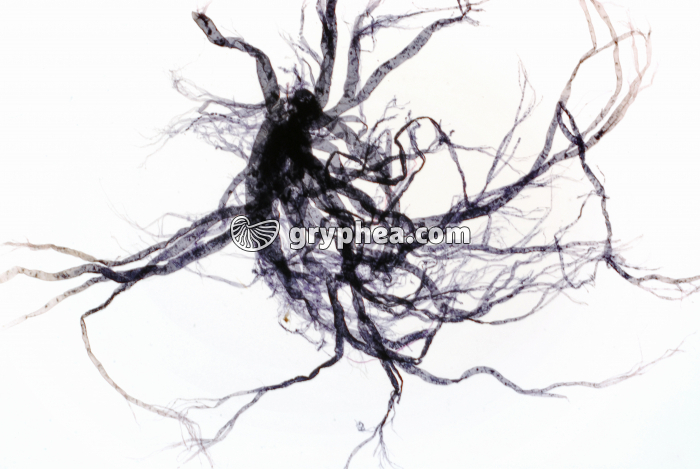 Trachées d'insecte isolées et colorées x5 - gryphea.com